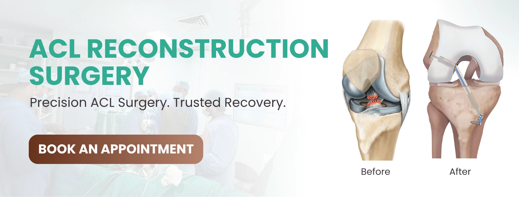 ACL SURGERY